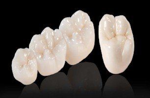 Choosing teeth for dental crown