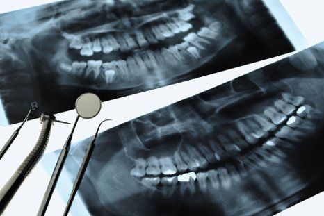 Two dental x-rays and dental tools