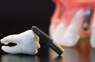 Teeth and screw for dental implant