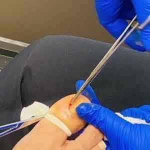 Foot and ankle pain