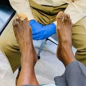 Diabetic foot