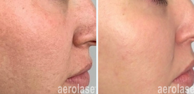 A before-and-after photo of a woman's face