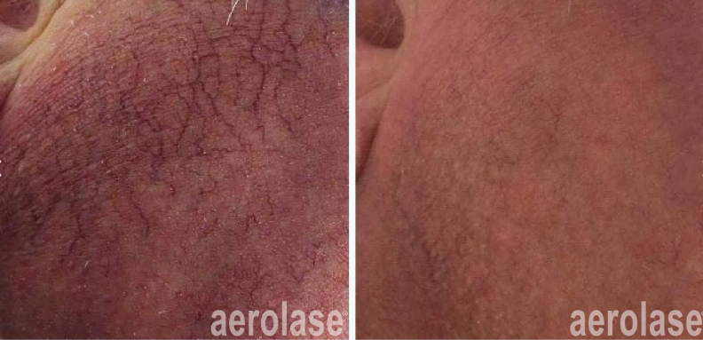 A before-and-after photo of a person's face