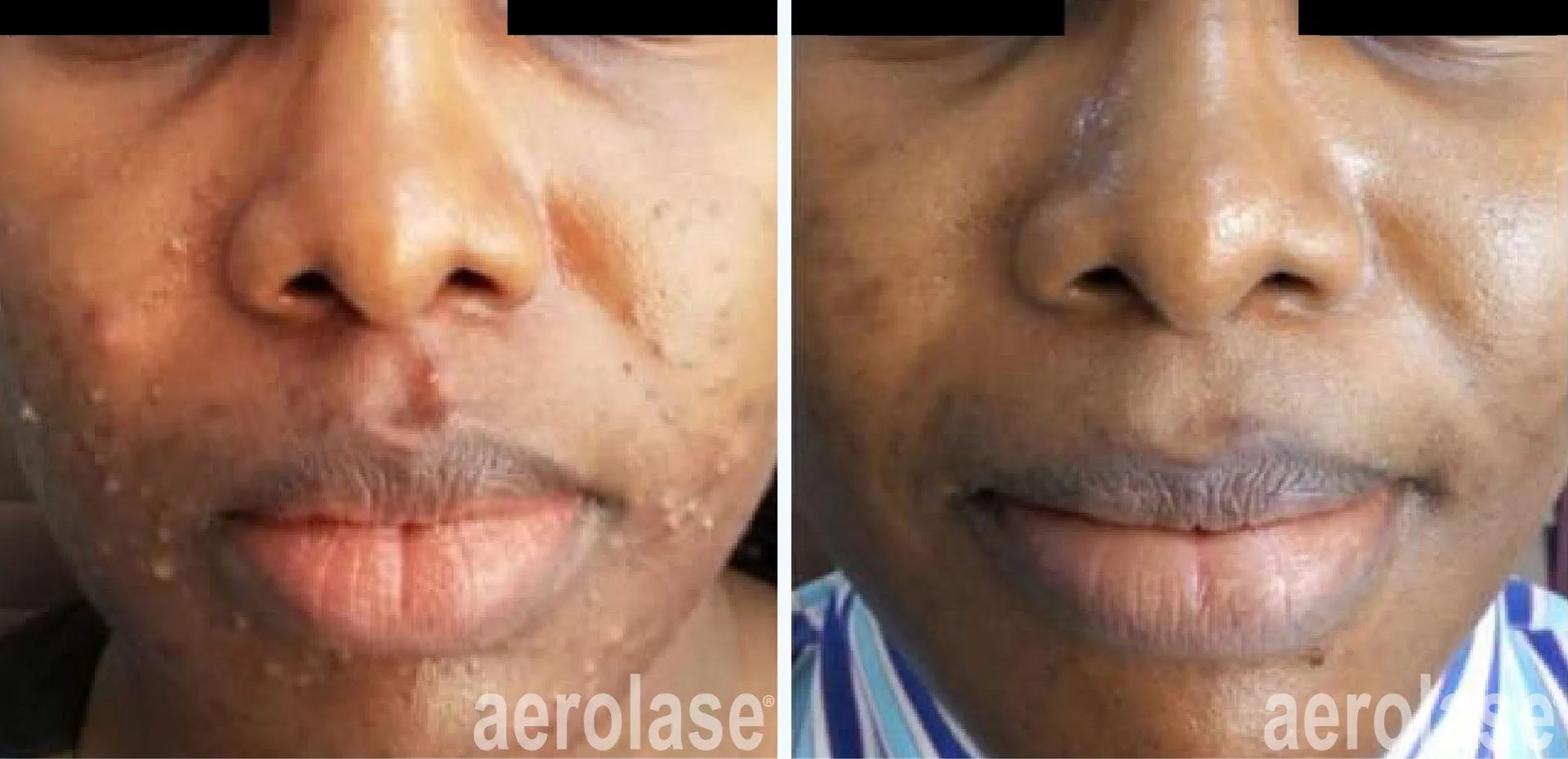 A before-and-after photo of a woman's face.