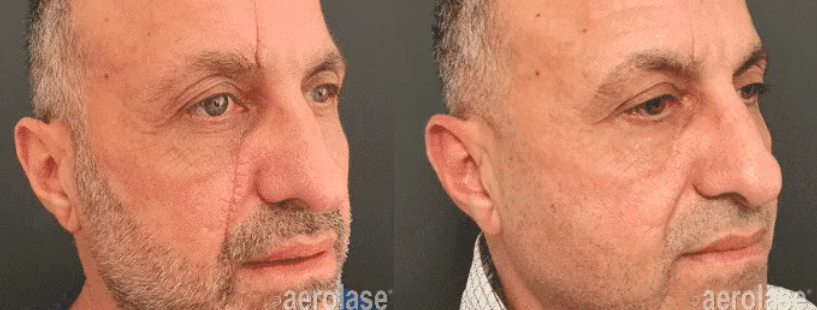 A man with a scar on his face is looking at the camera.