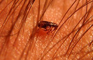 Fleas on skin