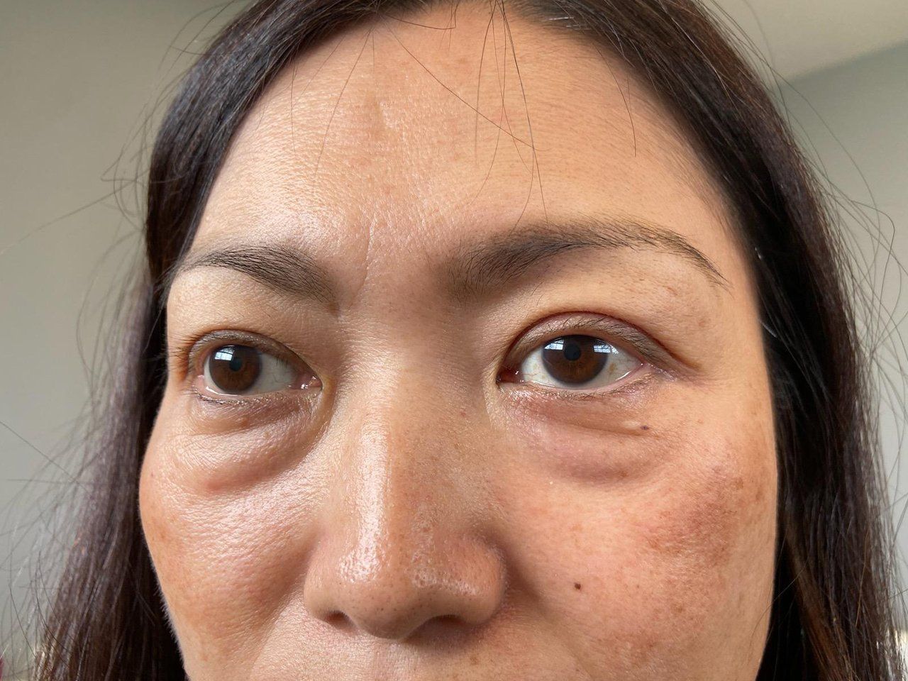 eyelash extension before