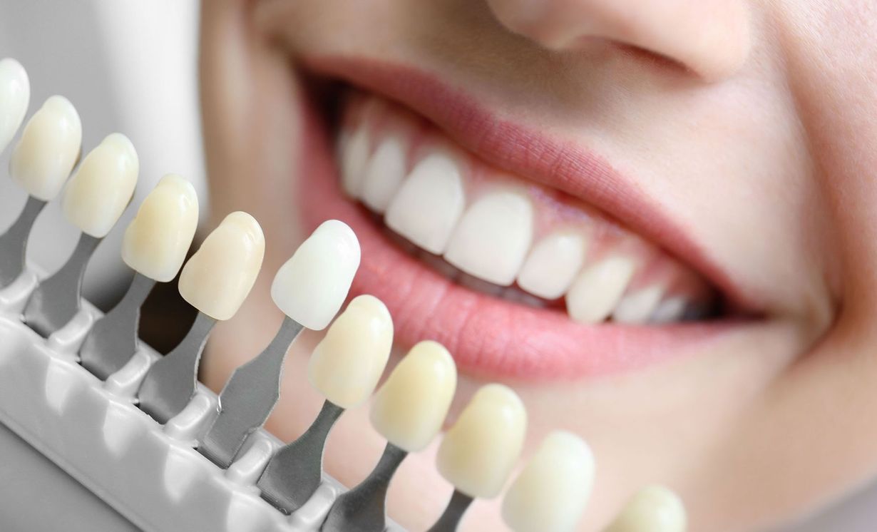 Nickles Dental Oral Surgery and Family Dentistry