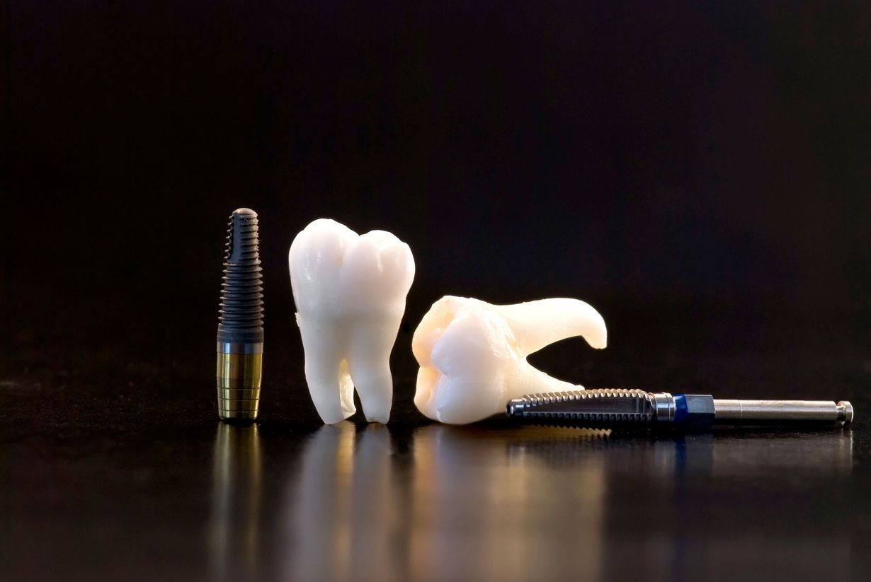 Kind Dental of La Mesa