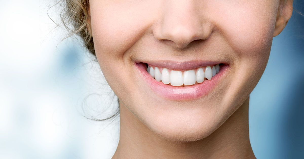 Smile Makeovers | La Mesa, CA