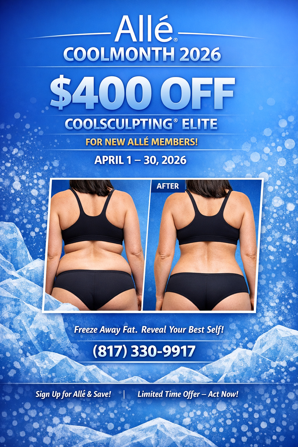 Promotional flyer offering $400 off CoolSculpting Elite for new Allé members in April 2026, featuring a before-and-after photo.