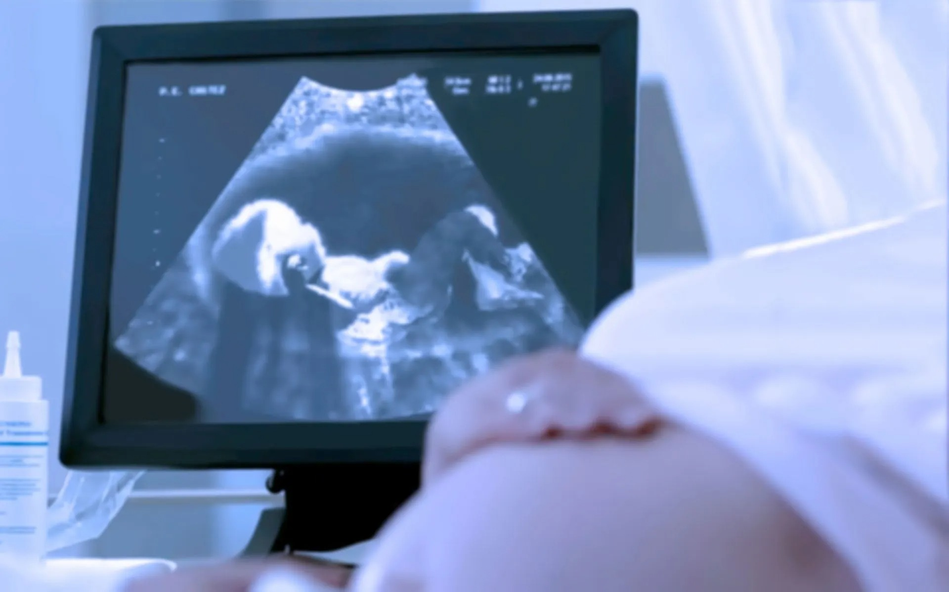 Ultrasound monitor displaying a fetus in grayscale, in a medical setting.