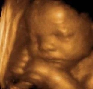 Fetal Memories 2D 3D 4D Ultrasound