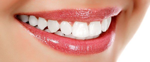 Teeth whitening