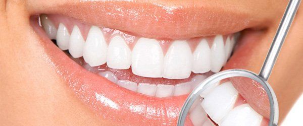 Teeth whitening