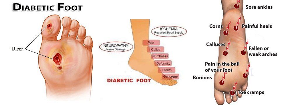 DIABETIC CARE