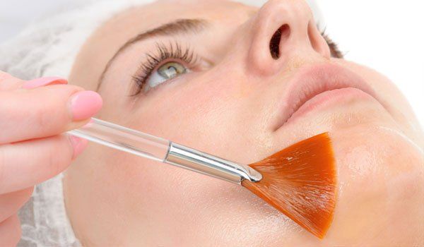 Chemical Peel