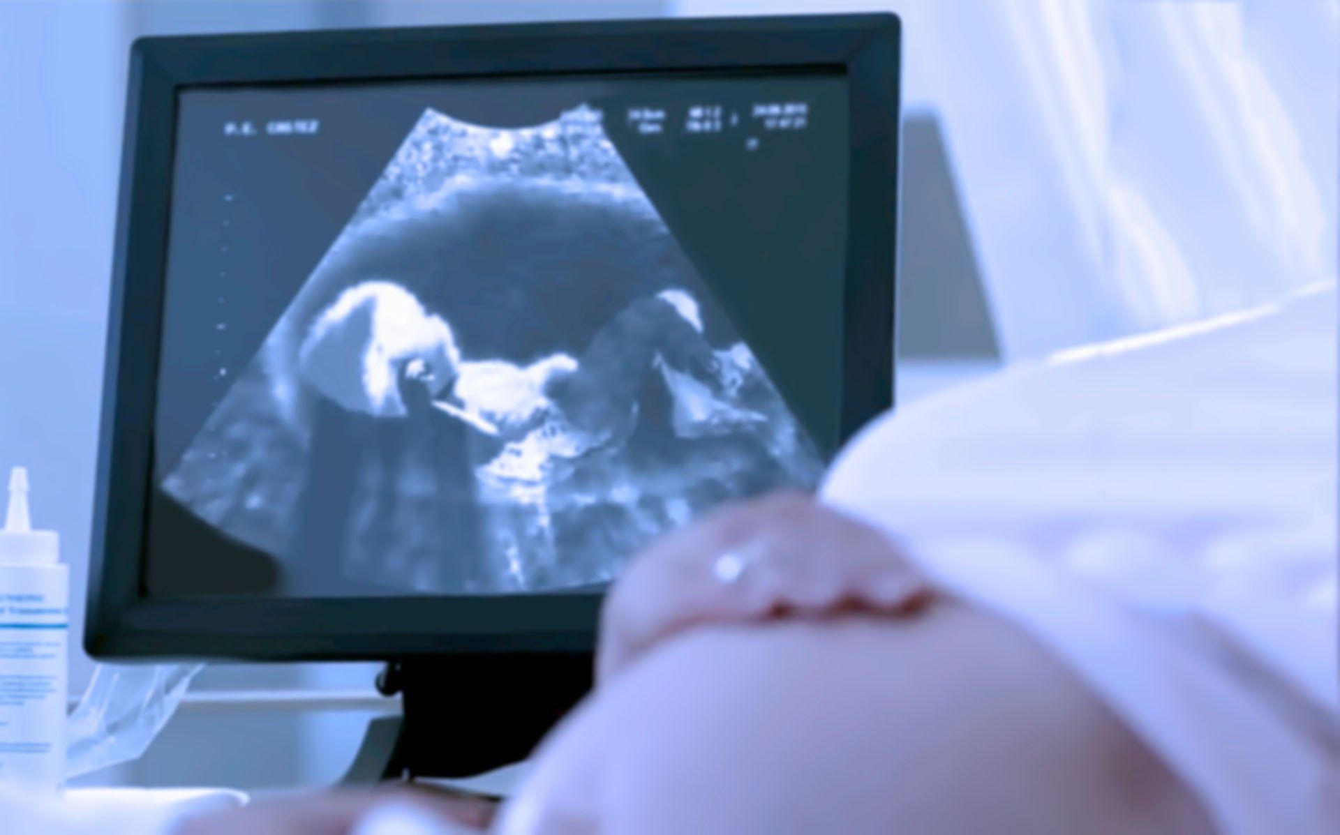 ultrasound