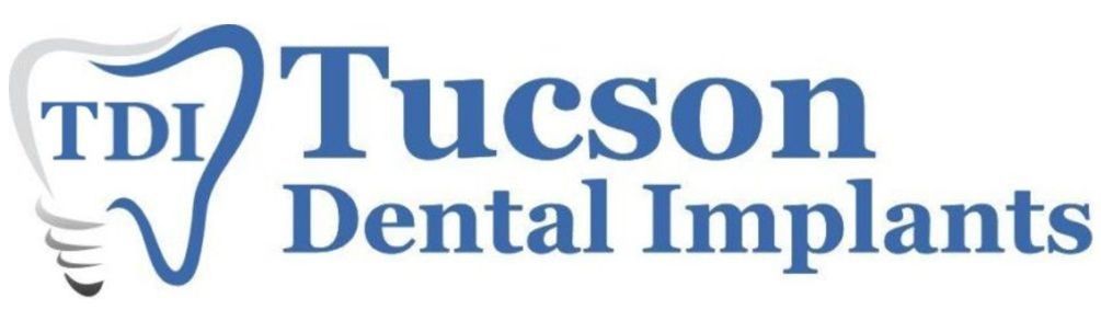 Logo for Tucson Dental Implants with a blue tooth icon and “TDI” lettering