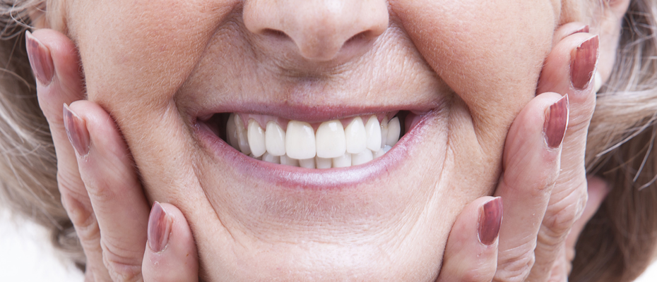 Lady with full dentures