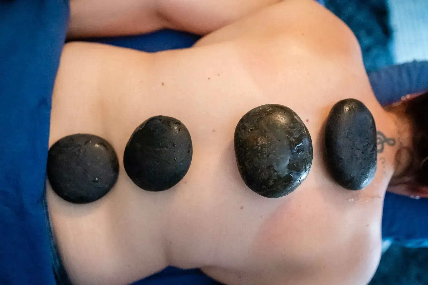 Person receiving a hot stone massage with dark, smooth stones on their back.
