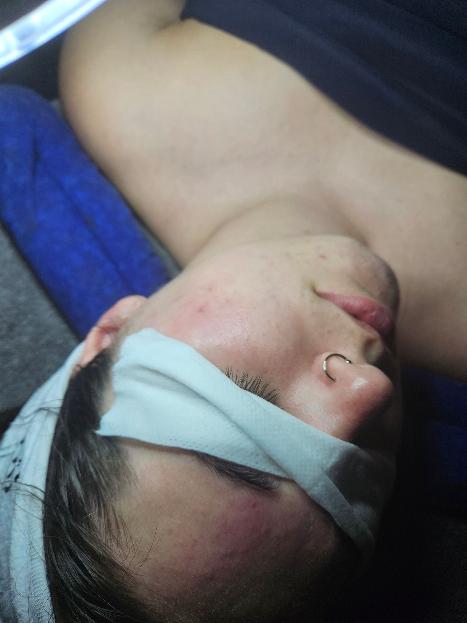 Person with a nose ring, eyes covered with a white cloth, head on blue surface. Skin shows slight redness.