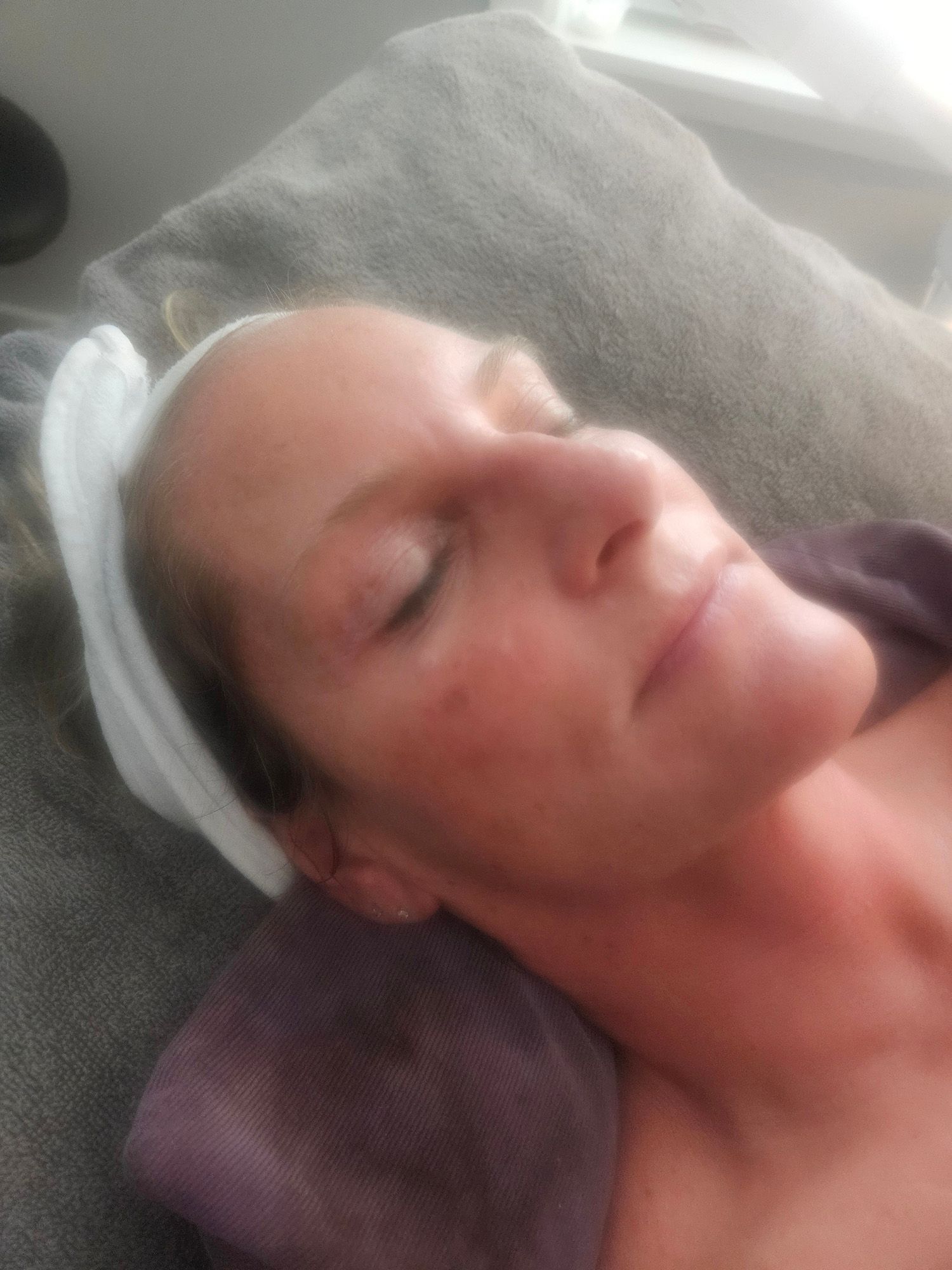 Woman with fair skin and closed eyes, lying down, face slightly flushed; wearing a white headband.