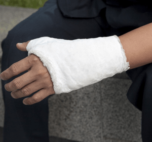 injured hand and arm