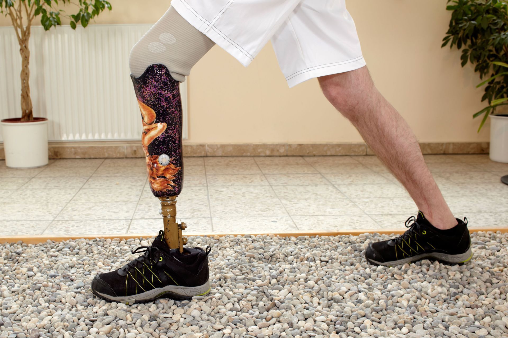 artificial leg