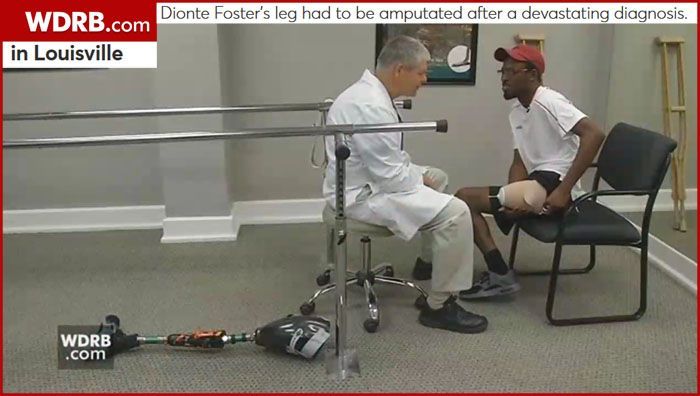 A doctor examining a man's leg after amputation in Louisville. A prosthetic leg is on the floor.