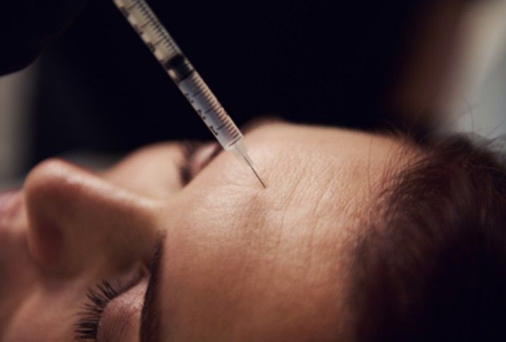 Syringe injecting into a patient’s forehead during a cosmetic procedure