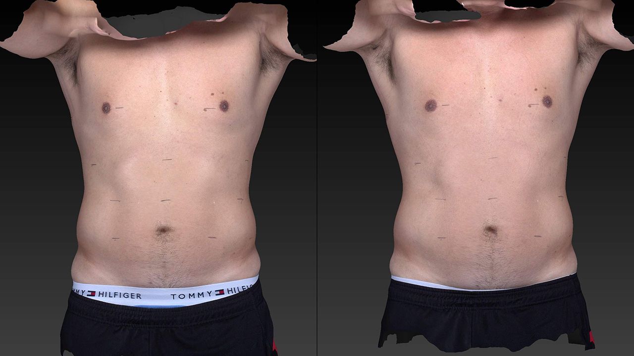 Before and after picture of a male with slimmer tummy