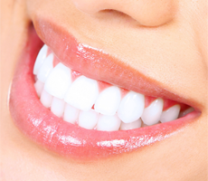 whitened teeth