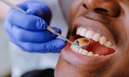 African male patient getting dental treatment in dental clinic