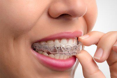 orthodontic services