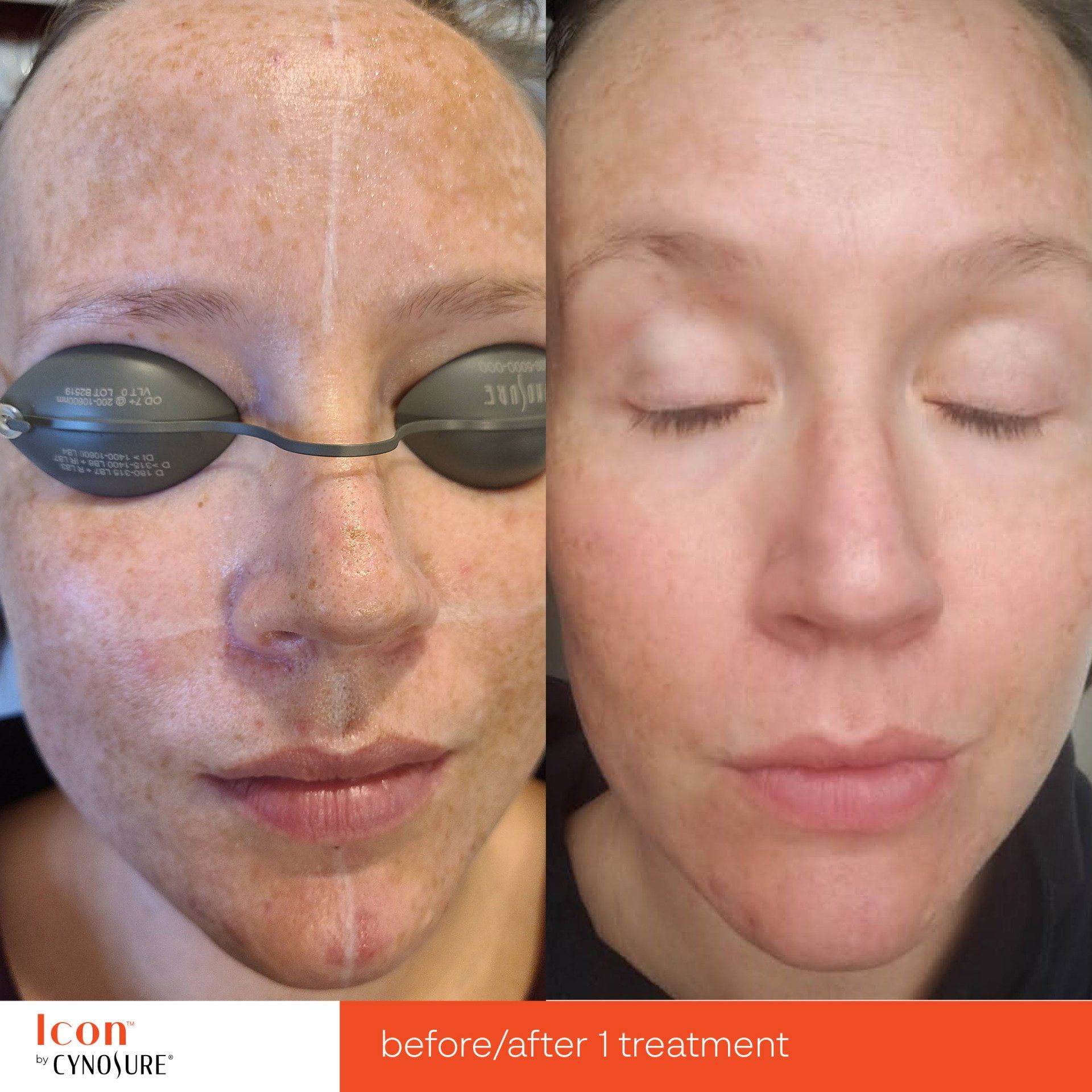 A before and after photo of a woman 's face