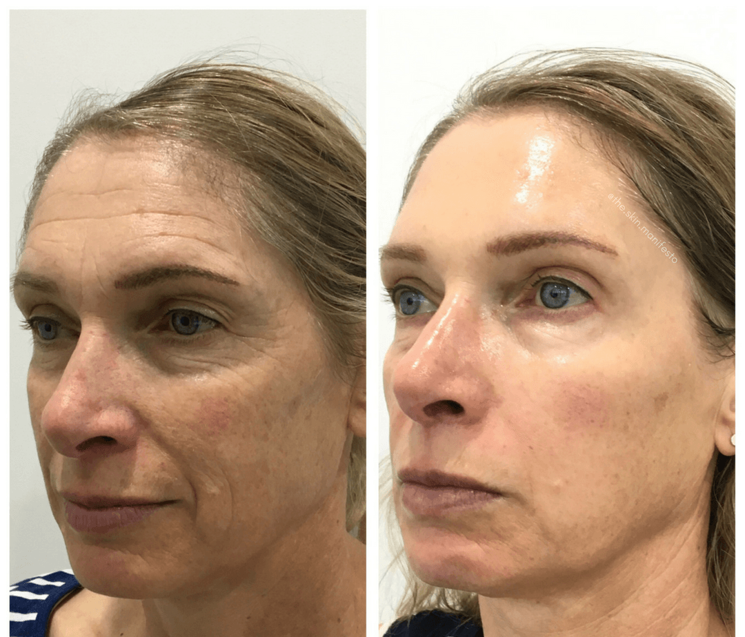 A before and after photo of a woman 's face.