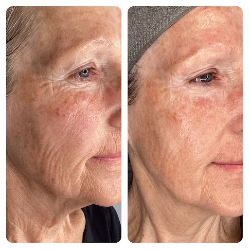 A before and after photo of a woman 's face.