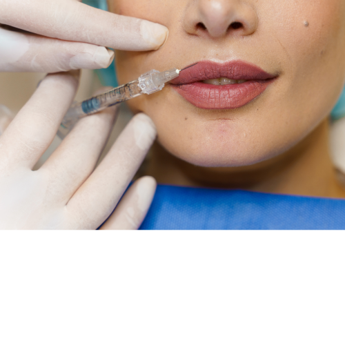 A person's lip being injected with a syringe by gloved hands.
