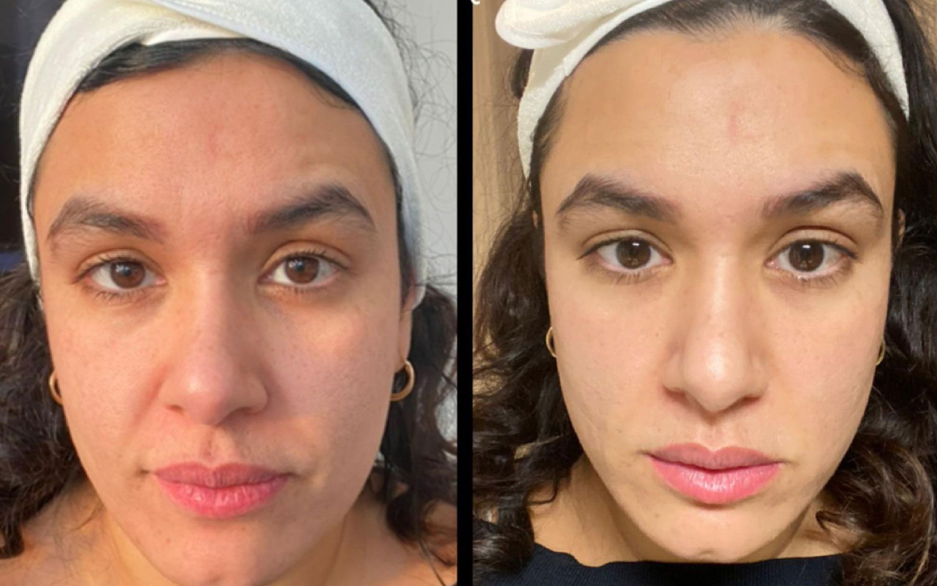 Side-by-side close-up of the same face, with bare skin on the left and a smoother complexion on the right.