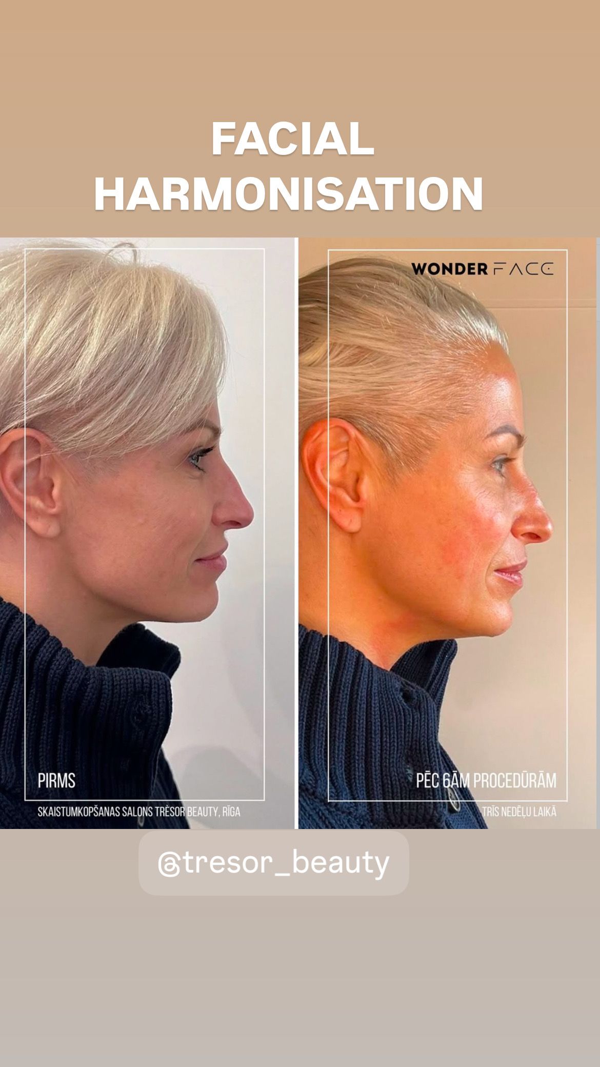 Before-and-after profile portraits showing facial harmonisation makeup: natural vs. enhanced orange-toned look