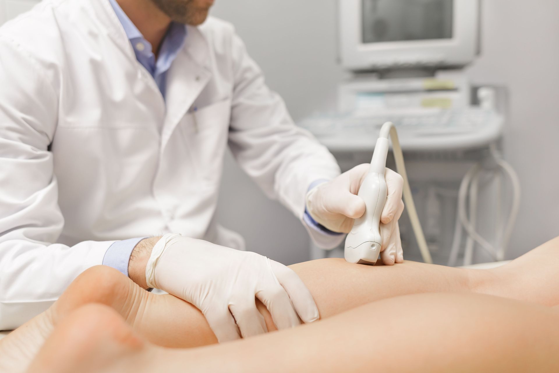 varicose veins treatment