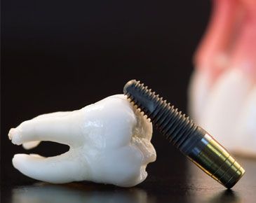 Reconstructive dentistry