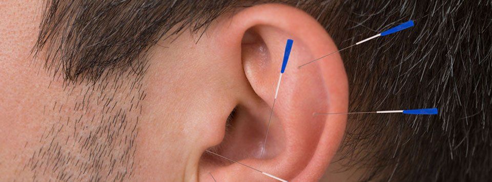 Acupuncture Pain Treatment