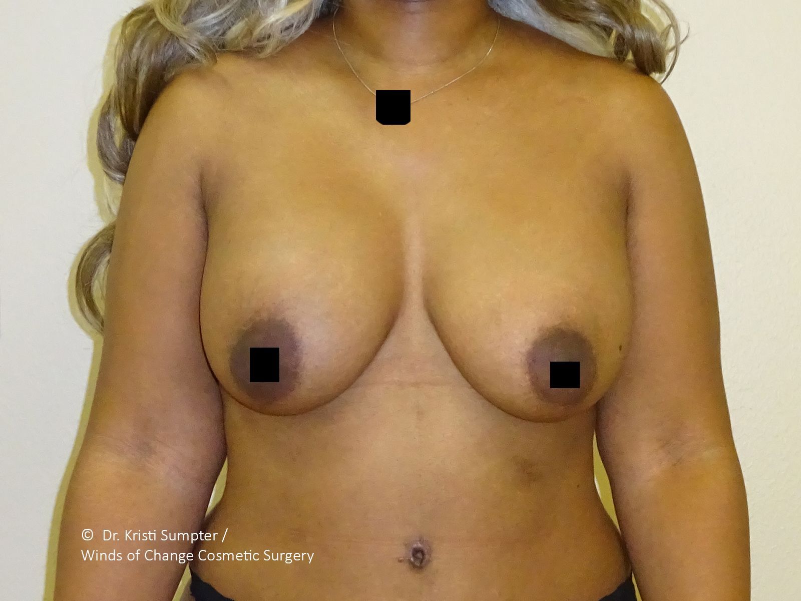 Topless adult torso with a necklace, centered against a plain background.