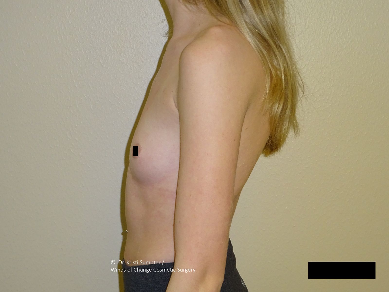Side-view torso against beige wall, with long hair and a black censor bar over the lower right.
