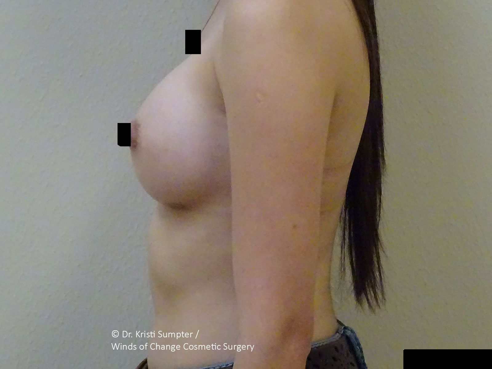 Side view of a shirtless person standing indoors, with black censor bars covering the chest.
