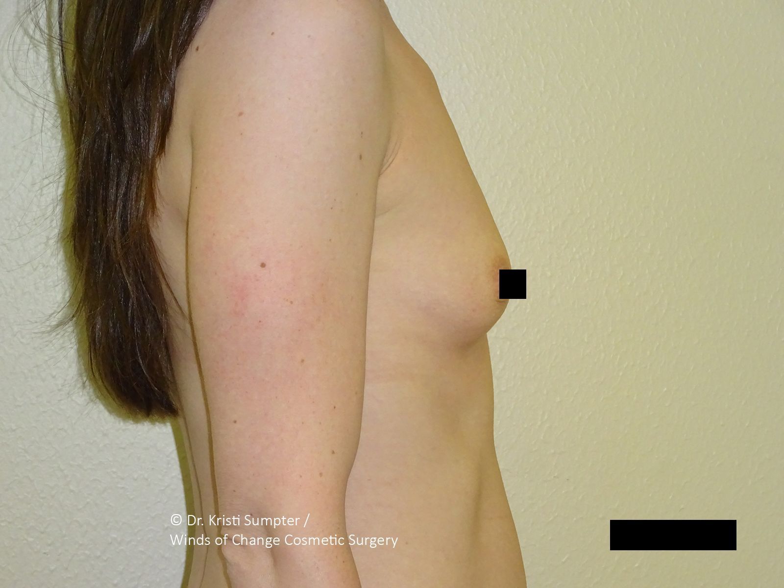 Side-view torso in a nude bra against a beige wall, with black censor bars covering the chest and lower area.