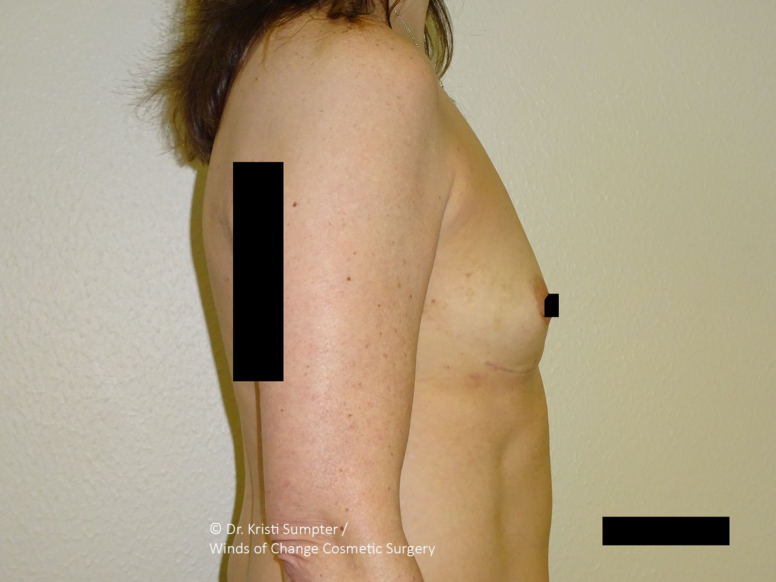 Side-view photo of a bare torso with black measurement bars marking chest and waist.