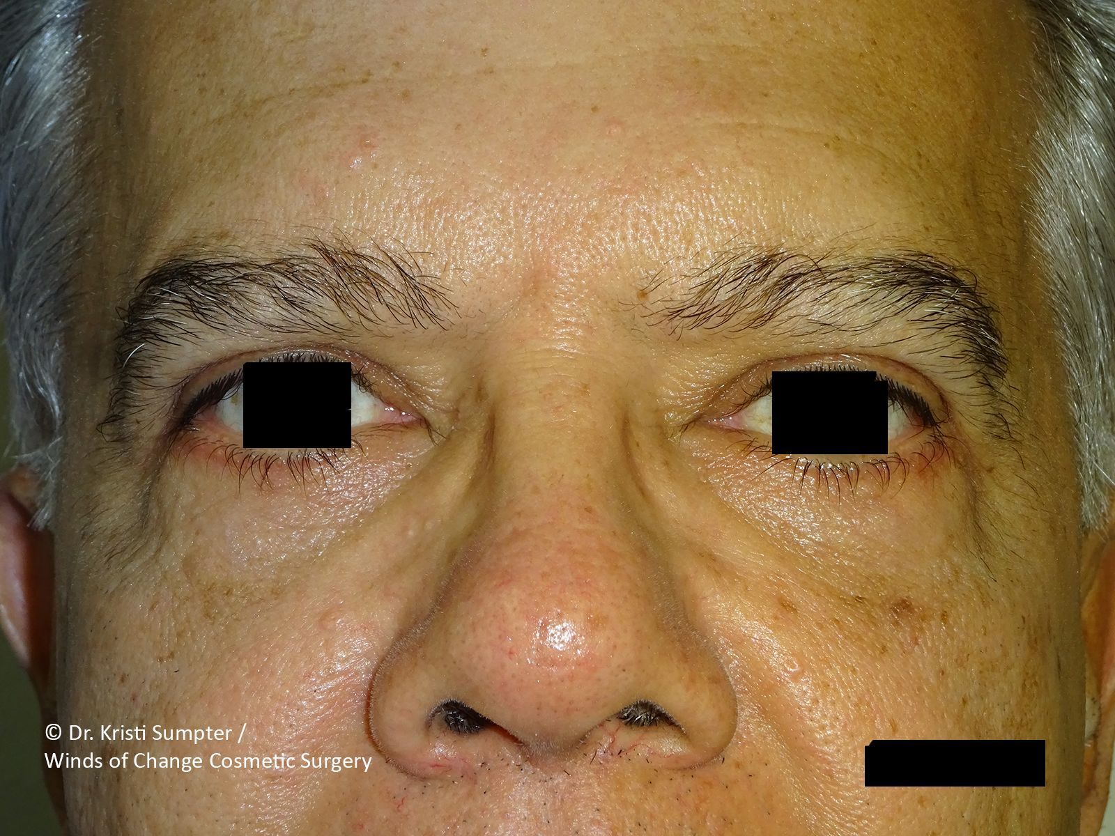 Close-up of a man's face looking forward after.